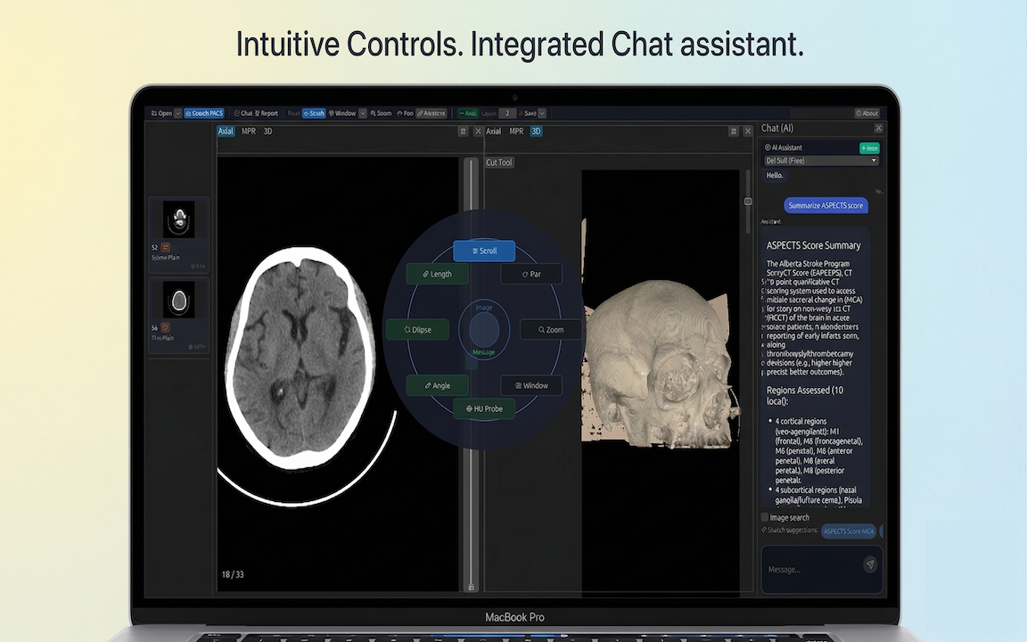 DN Viewer chat and AI features