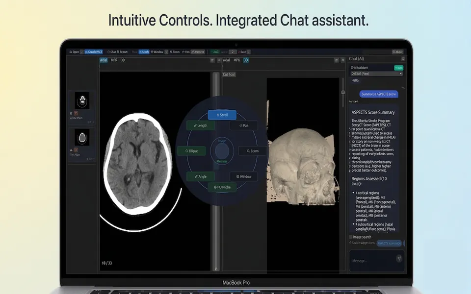 DN Viewer desktop workspace with DICOM image views and the integrated AI chat assistant