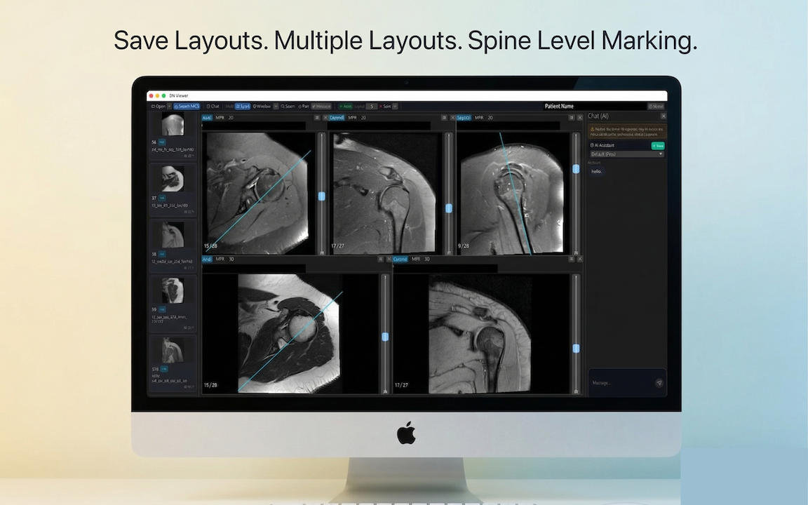 DN Viewer MRI layout memory