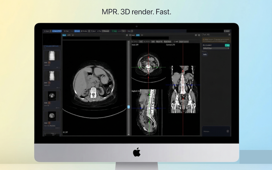 DN Viewer near-instant MPR